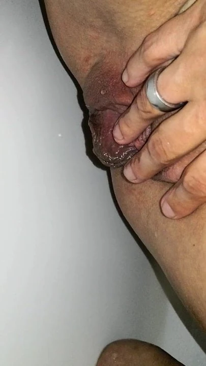Abspritzen