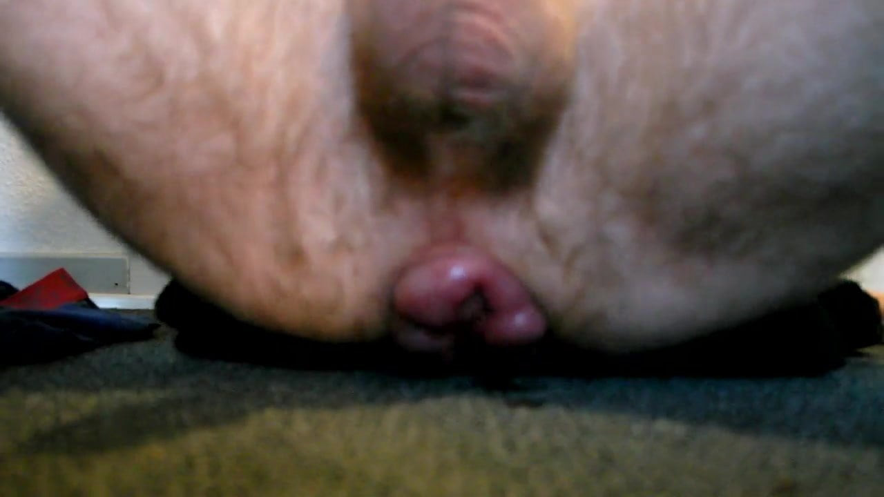 Prolapse