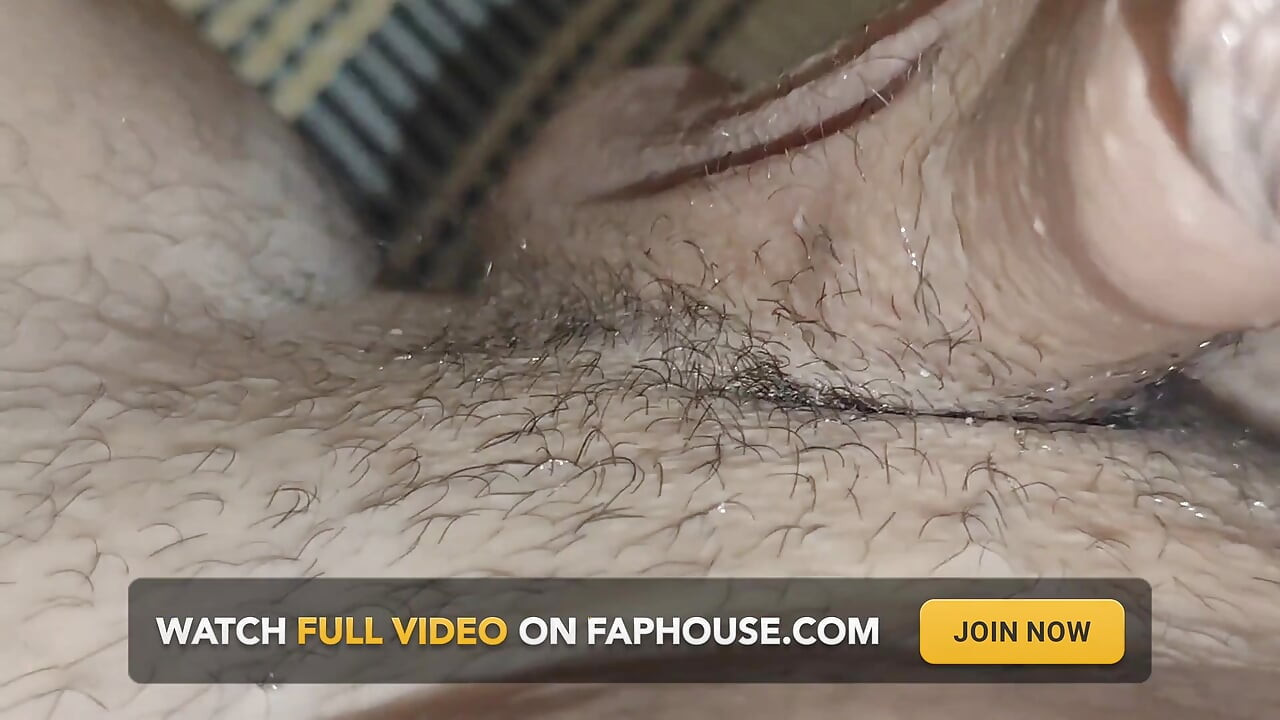 Detaching the Foreskin From the Glans Slowly.