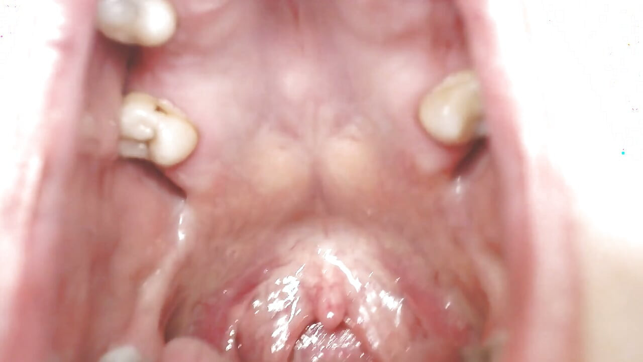 Throat and Mouth Spit Strings Uvula Tonsils Uvula