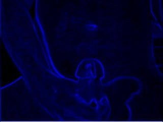 Éjaculation en bleu