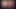 アップルDp