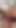 Spectacular moment from "PINHOLE XXX. Hospital anal fun with my doctor"