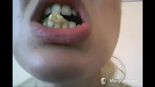 Зубы Chantal разваливаются, Rotten и Black