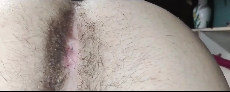My Hairy Anus