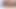 Pepper utangaçlığını iyileştirmek için