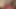 New GF Circumcision Worship