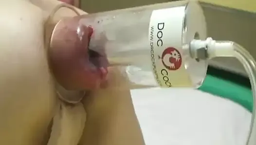 XXL anal vacuum pumping and fisting