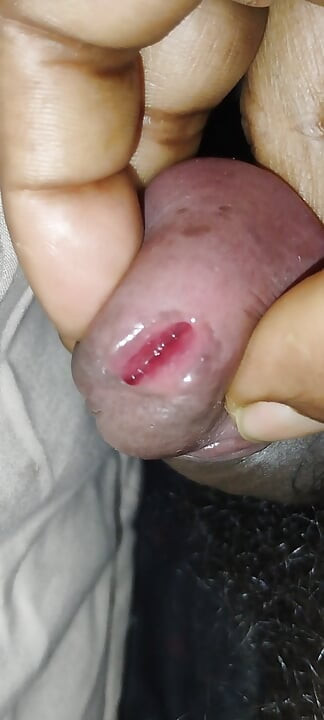 Adam için peni nemlendirici