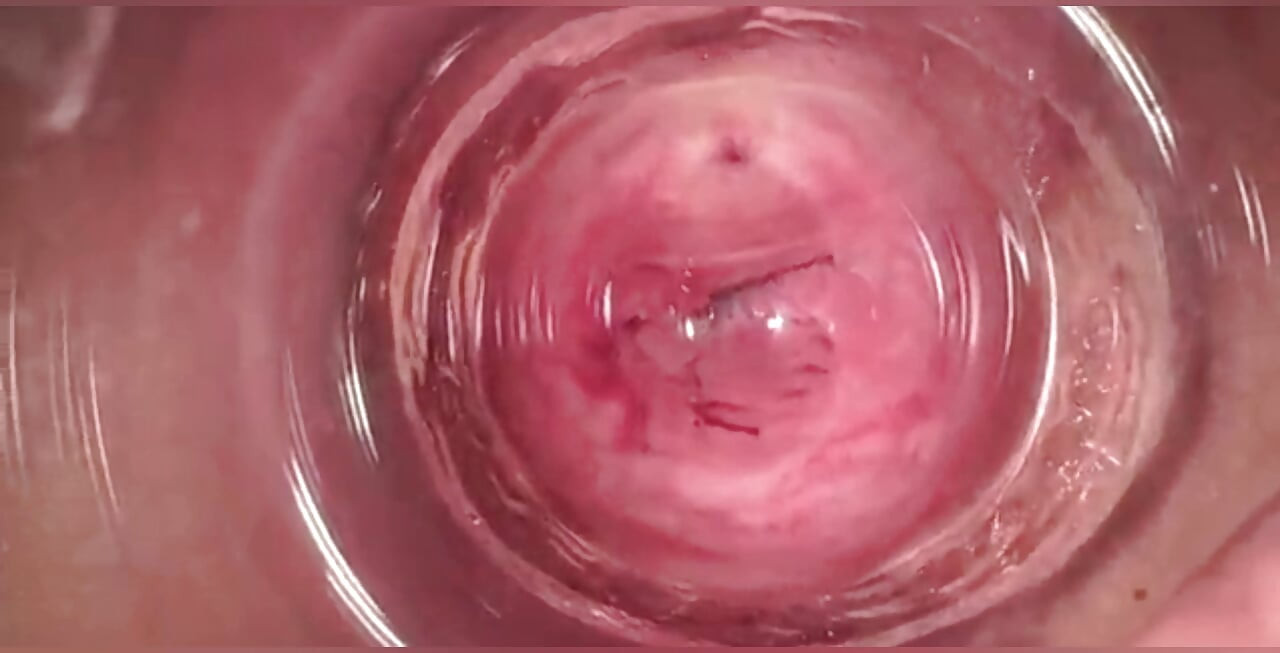 Kamera in vagina, Gebärmutterhals, pOV, creampie