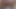 Lizzy Yum VR April 2023 JUST Anal #2 post op orgasm pussy anal masturbation teasing orgasm toys