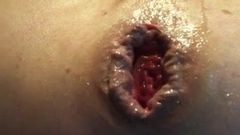 Man-fitta gapande prolaps anal hål sträckt rövhål