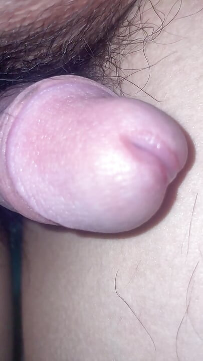 Massage the prostate and urethral bulb fluid.