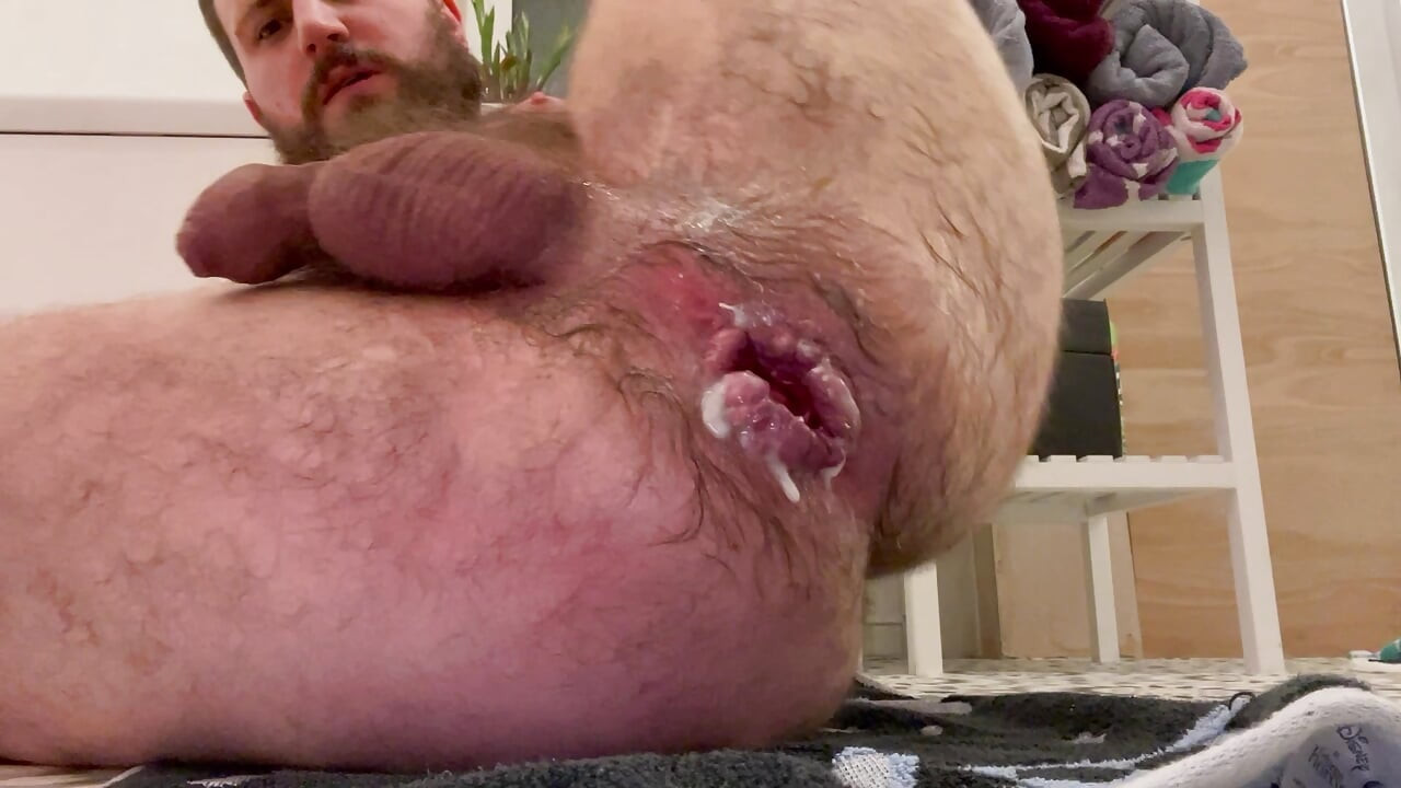 ยืดรูของฉัน