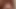Extreme, anal gaping with a huge dildo