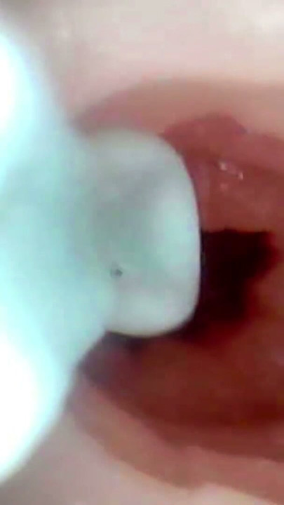 A detailed examination of Lopuza93 oral cavity and anal area using an endoscope camera. | Clip 3