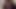 タンパク質のボビン