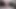 Ayakkabısız belden aşağısı felçli kız spazmı