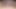 Releasing the glans from the foreskin - A compilation