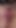If You Like Butthole and Pussy Spreading Accidental Queefing This One's for You