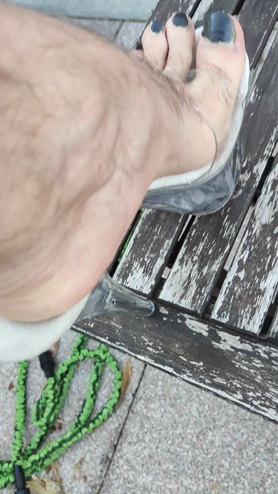 Black toenails