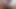 Masturbating in hospital