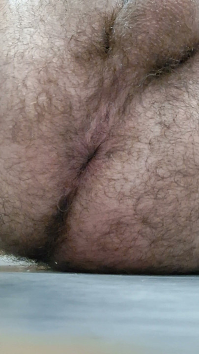 Asshole in close-up