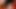 katheter spiele vorbereitung zur spermaentnahme