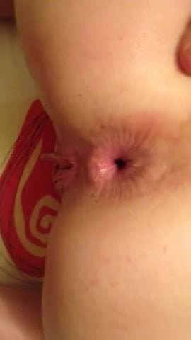 anal !