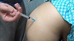 2 injections fat butt