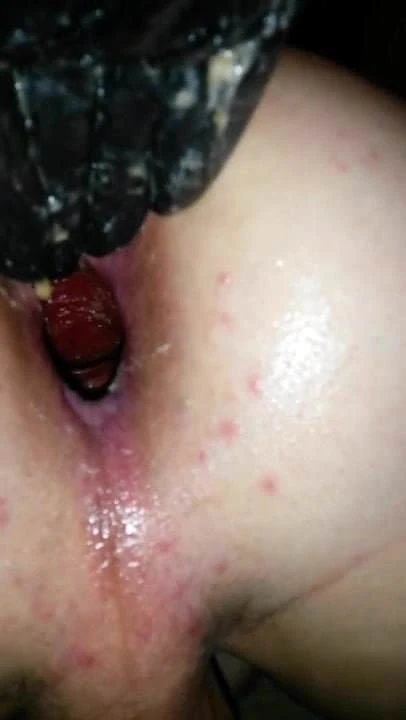 1 Hand Anal Fisting Gaping Asshole