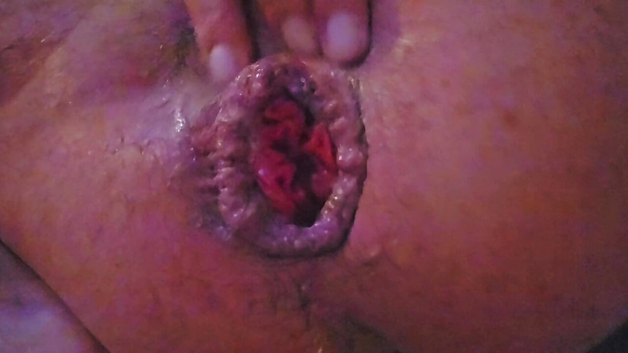 Anal fingering