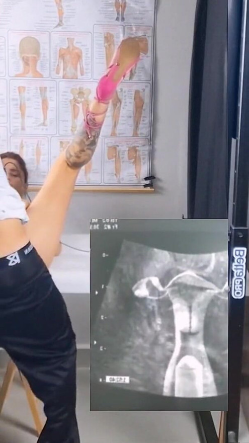 Wife cheating on husband on ultrasound with gynecologist! | Clip 3
