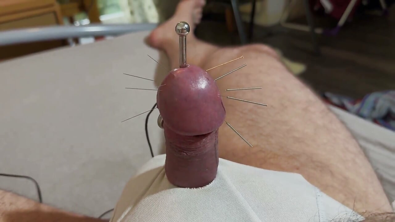 최고의 침술 방법!