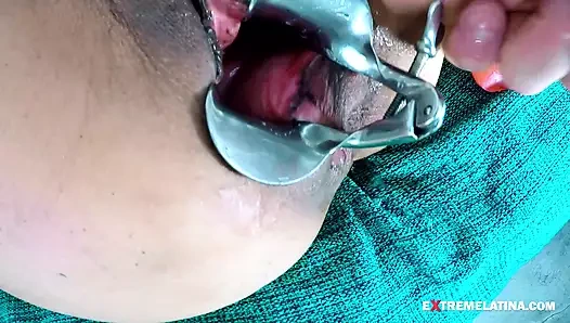 Exl-032: Огромное гинекологическое зеркало в заднице и киске. Огромный пролапс и огромная шейка матки. Полная экстремальная сцена, экскл-032