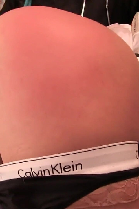 신 세이지, 체리 데빌을 특징으로 참을성이 없는 환자