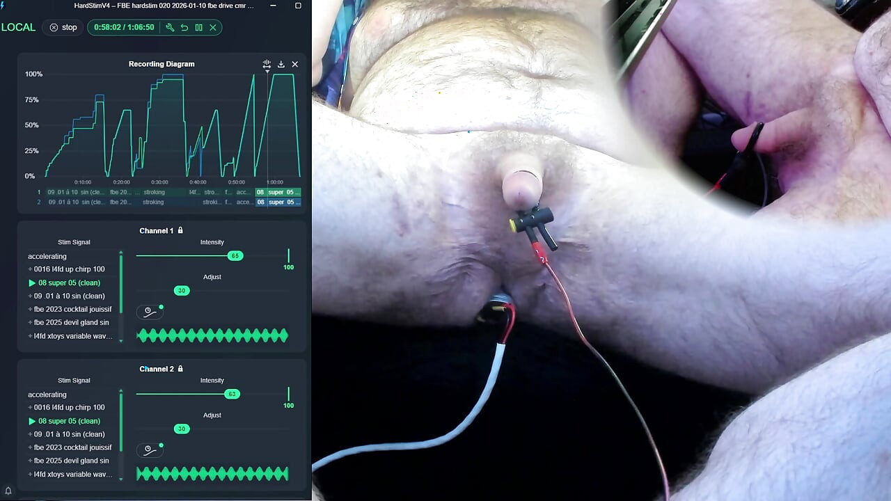 FBE Hardstim 020 Another Ride (Different Electrode)
