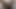 Lizzy Yum July 2023 Just Sunday Post-op Orgasm Pussy Clit Masturbation Teasing Orgasm