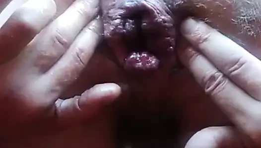 anal