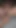 Orta yaşlı seksi kadın amını teftiş ediyor ve içine görmek için spekulum sokuyor | Klip 1