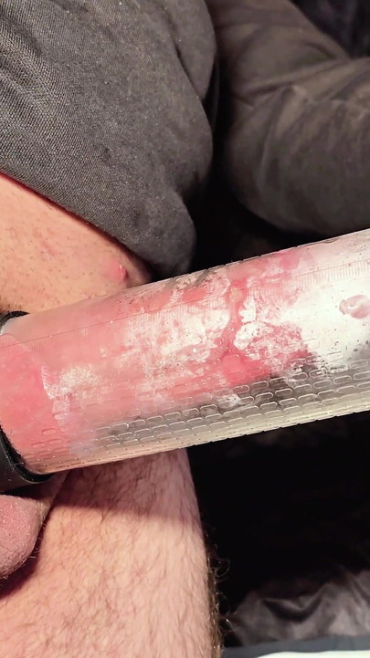 Key moment from "Huge multiple cum in a condom! I use a vacuum pump to help."