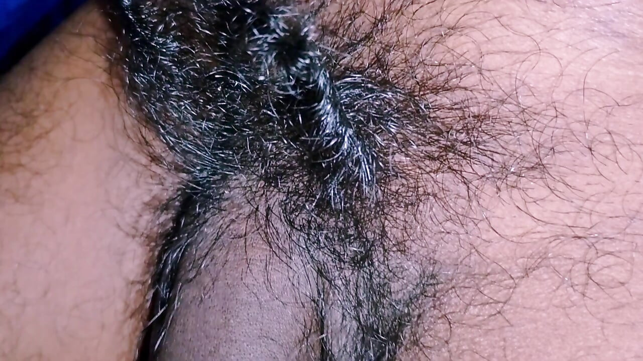 Long hair of penis