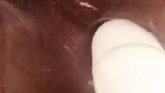 Göt deliği 3