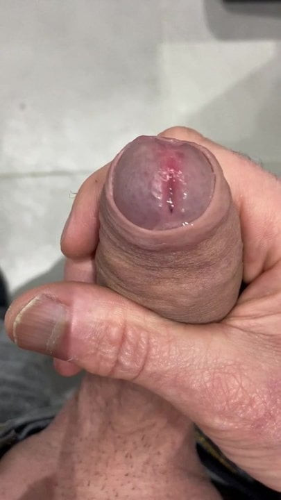 Bite