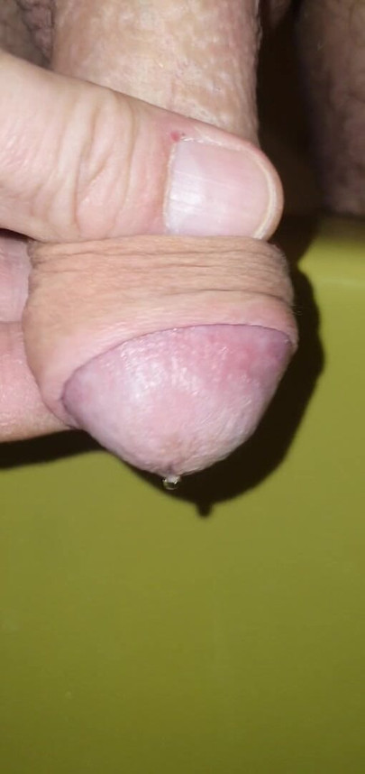 pee