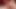 Tease