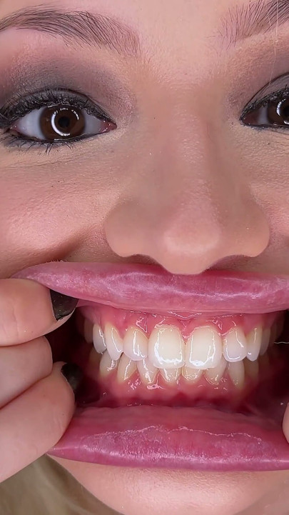 Teeth Brushing Fetish Closeup Stella Fatale French Open Mouth Gargle & Spit Play