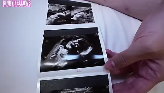 Can Desire Still Burn at 26 Weeks Pregnant? a J Cup Gravure Idol Dares a Risky Mini Uniform Fantasy