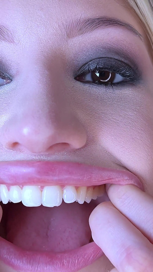 Perfect Natural Teeth Fetish Show All Teeth Including Wisdom Teeth