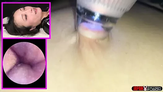 Hana Kano - Экстремальная разведка живота кнопом, часть 2: присоска и микрофлорикое наблюдение